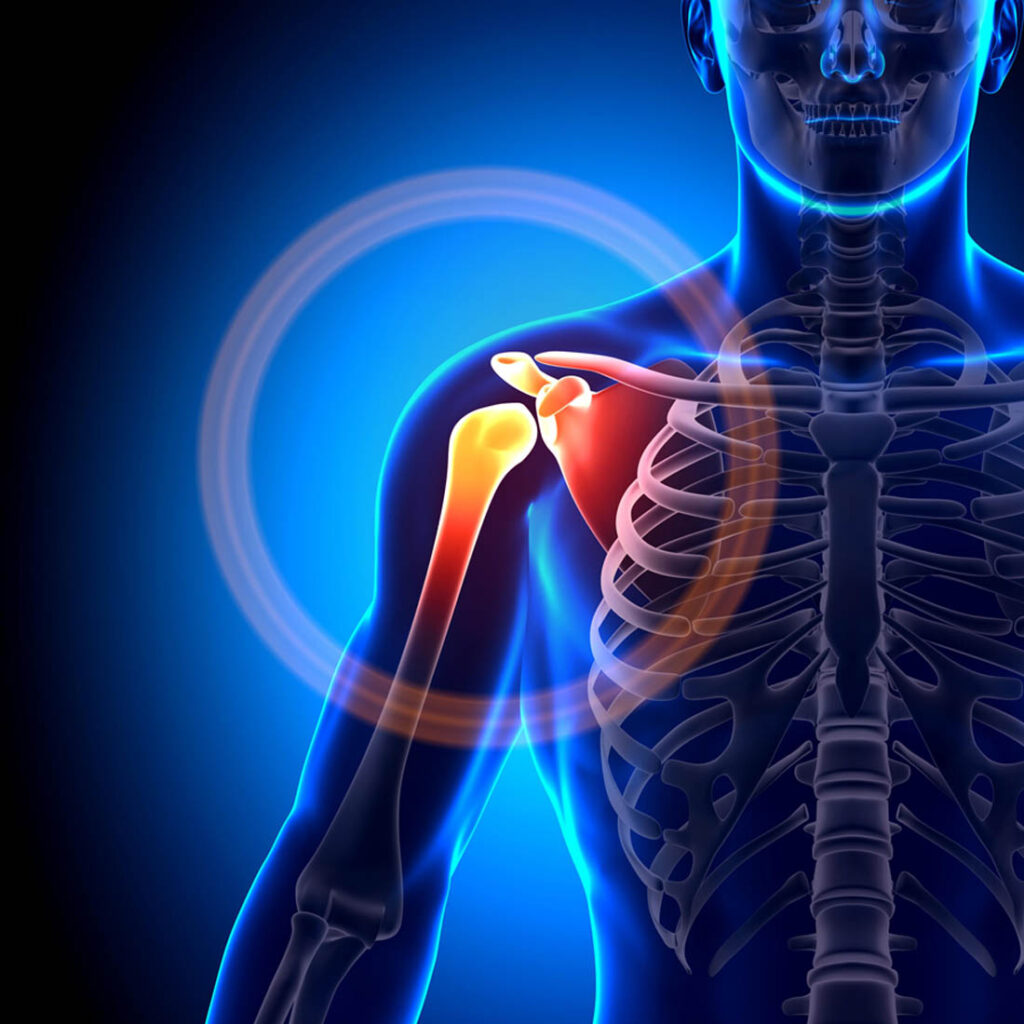 Shoulder pain